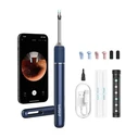 Bebird Note5 Ωτοσκόπιο