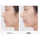 Medicube AGE-R Booster Pro Black (Face Phototherapy / Beauty Booster Device)