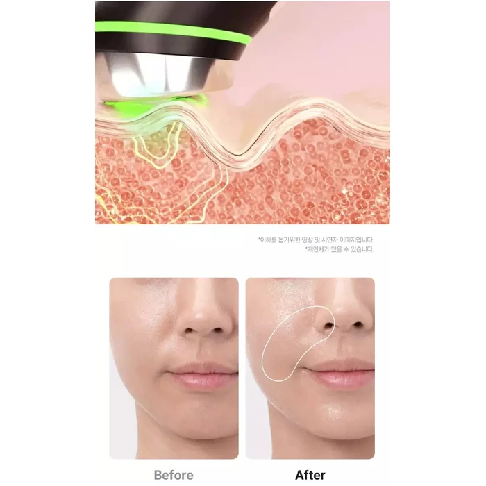 Medicube AGE-R Booster Pro Black (Face Phototherapy / Beauty Booster Device)