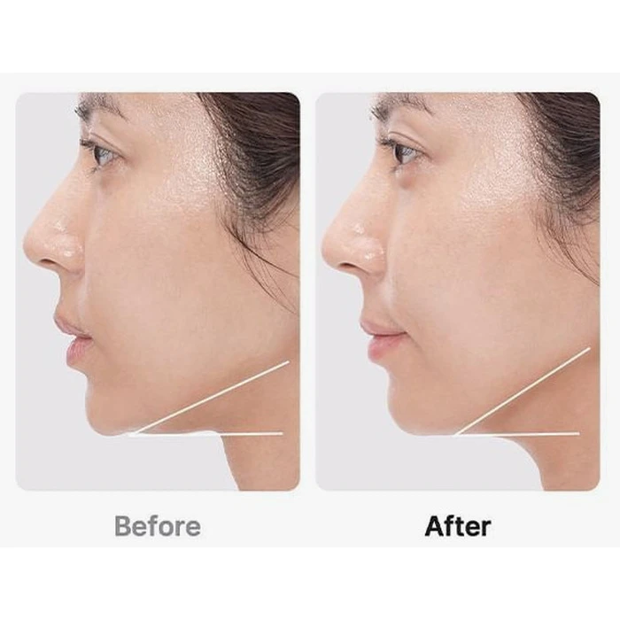 Medicube AGE-R Booster Pro Black (Face Phototherapy / Beauty Booster Device)