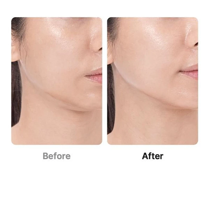 Medicube AGE-R Booster Pro Black (Face Phototherapy / Beauty Booster Device)