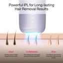 Ulike Air3 Συσκευή Αποτρίχωσης IPL Provence Μωβ